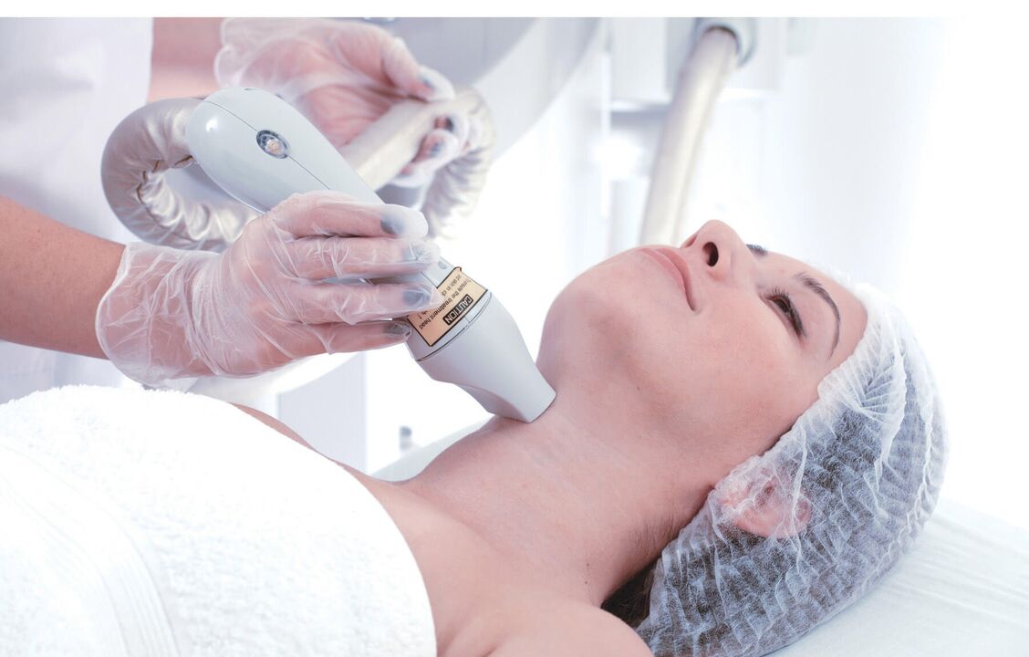 Non-critical laser neck treatment