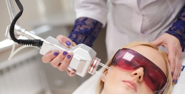 The principle of the renewal of the face with laser