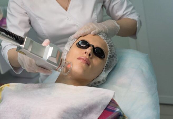 A scene renewal with laser