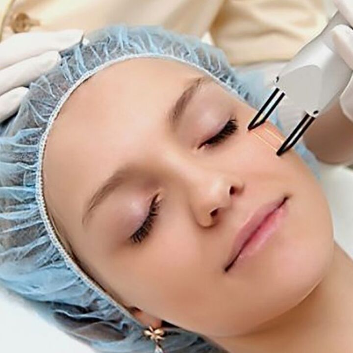 Renewal of solvent fractures