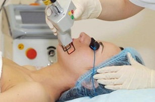 laser facial skin rejuvenation types